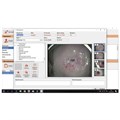 Кольпоскоп КС-02-302 Zoom Комфорт с видеокомплексом 10015